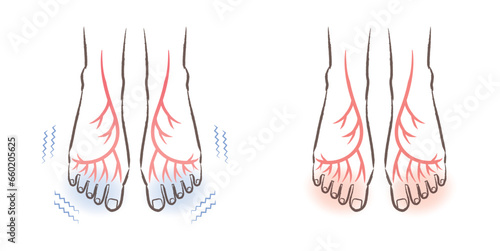 冷え性の足先　ぽかぽかの足先　血流　血管のイラスト　ビフォーアフター