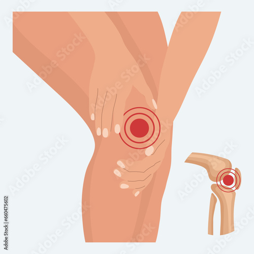 Pain in the knee joint, knee arthritis, leg pain due to rheumatoid arthritis. Anatomy of human bones. Illustration, vector