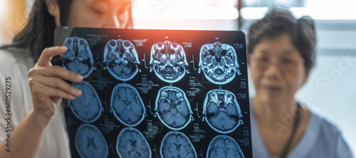 Fotografie Magnetic Resonance Imaging (MRI) film for Brain disease diagnosis with medical d