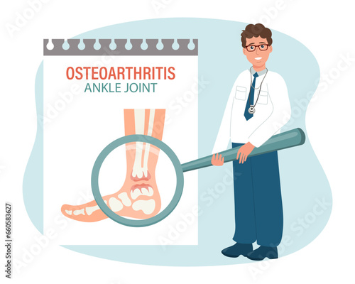 Rheumatoid arthritis. Arthrosis of the human ankle joint. Male doctor with a magnifying glass. Medical infographic banner, poster, vector