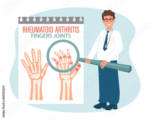 Rheumatoid arthritis. Osteoarthritis of the joints of the fingers. Male doctor with a magnifying glass. Medical infographic banner, poster, vecto