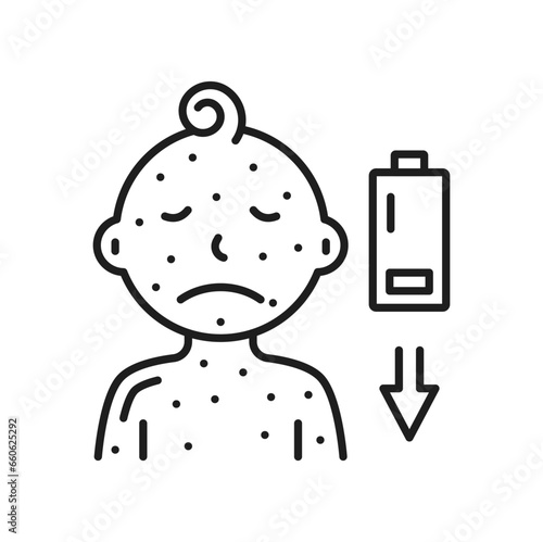 Chickenpox treatment ointment, varicella disease medication cream bottle. Vector body and face of child with skin rash, small, itchy blisters