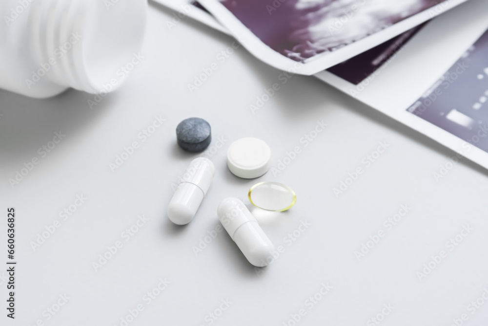 pills and ultrasound scan on a white table pills and ultrasound scan on a white table