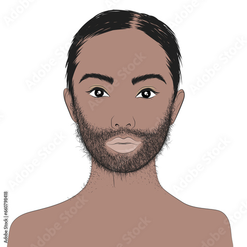 Hypertrichosis, excessive hair growth, either in quantity or thickness, on any part of the body. photo