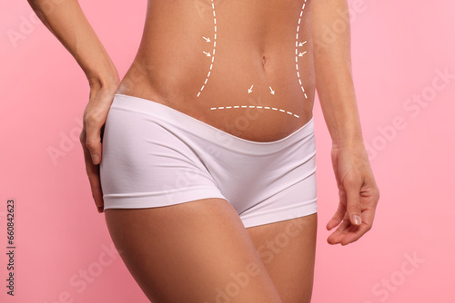 Woman with markings for cosmetic surgery on her abdomen against pink background, closeup