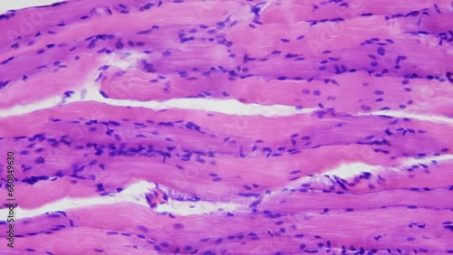 Bodybuilder muscles. Effect of Anabolics and growth hormones. Human skeletal muscle tissue under microscope, 400x times magnification. Longitudinal section. Smooth focusing and movement photo
