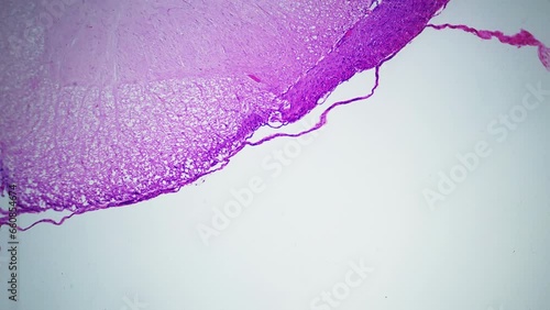 Human nerve fiber bundle under microscope. Cross section. 100x times magnification. Each bundle of nerve fibers is called fasciculus and is surrounded by layer of connective tissue called perineurium photo