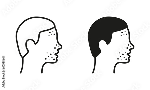Dermatologic Problem, Allergy, Inflammation Skin Symbol Collection. Boy with Face Pimples Line and Silhouette Black Icon Set. Man with Blackhead, Acne, Rash Pictogram. Isolated Vector Illustration