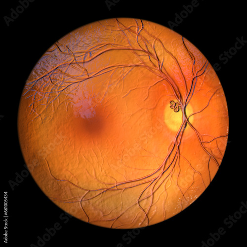 A prepapillary vascular loop on the retina, 3D illustration photo