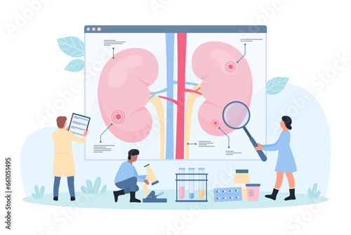 Kidney disease, nephrology vector illustration. Cartoon tiny doctors study science infographic diagram of human kidney with magnifying glass, nephrologists research patients physiology and symptoms