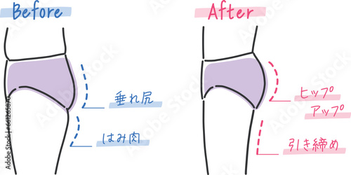 垂れ尻と美尻の比較イラスト素材