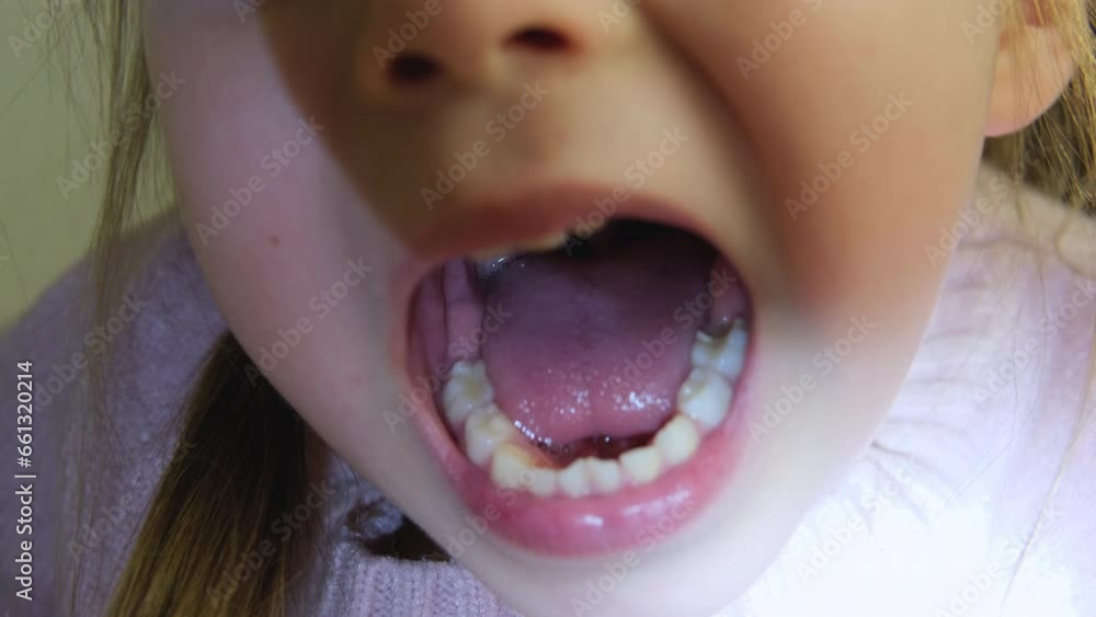 Little girl plays with tongue and saliva. Close-up of a girl open mouth. child shows throat and palate to the doctor. Health concept. Play and stick out your tongue and teeth. Salivation in children. ▶0:09  