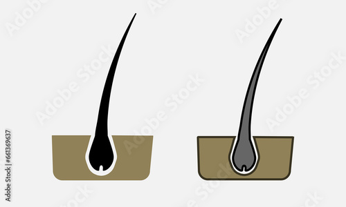 Hair follicle