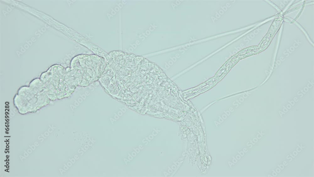 Larva of parasitic worm Progonus muelleri under a microscope, at ...