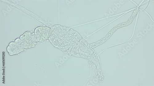 Larva of parasitic worm Progonus muelleri under a microscope, at Cercaria stage. Class Trematoda. White Sea photo