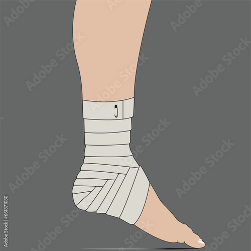 broken leg with plaster, bandaging sprained ankle - vector illustration