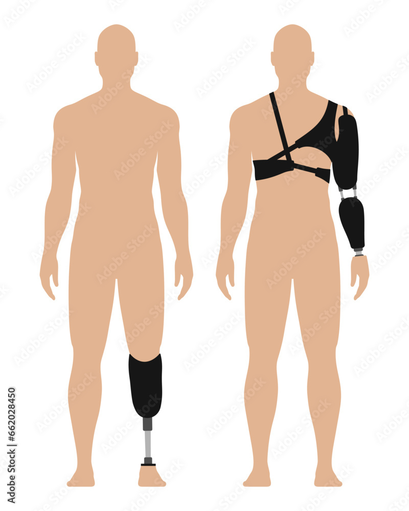 Fototapeta premium Man with prosthetic arm and leg, medical vector illustration set, isolated on white background.
