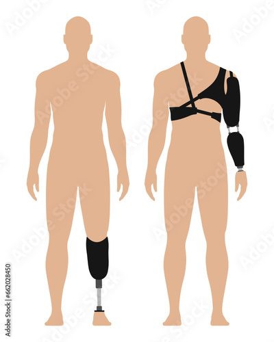 Man with prosthetic arm and leg, medical vector illustration set, isolated on white background.