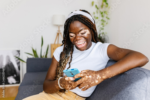 Young african woman with vitiligo using mobile phone sitting on sofa at home. Technology and social media concept.