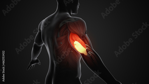 Pain and injury in the Triceps Muscles