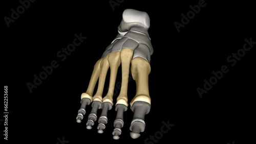 The metatarsal bones are the bones of the forefoot that connect the distal aspects of the cuneiform . photo