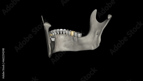 The mandibular first molar usually has two roots, a mesial and a distal. photo