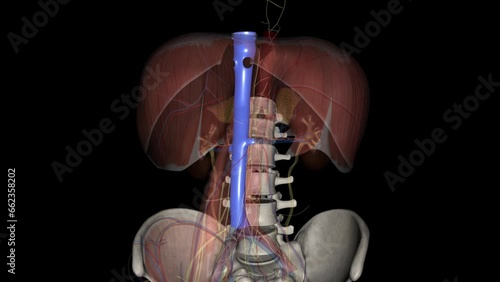 The inferior vena cava (IVC) is a large retroperitoneal vessel formed by the confluence of the right and left common iliac veins . photo