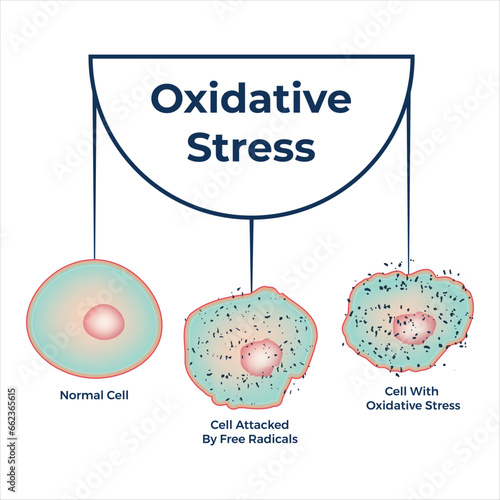 Oxidative Stress. From Normal Cells to Attack Free Radicals and Cell Death by Apoptosis or Necrosis. Vector Design. Normal Cell, Cell Attacked by Free Radicals, Cell With Oxidative Stress.