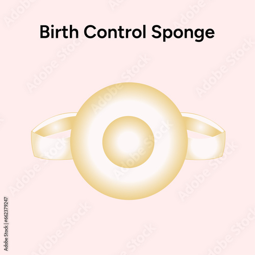 Birth control sponge contractions illustration