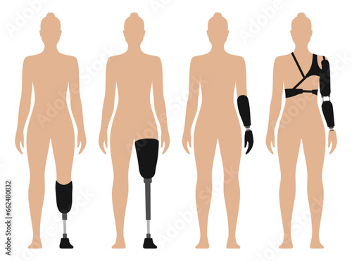 Woman with prosthetic arm and leg, medical vector illustration set, isolated on white background.