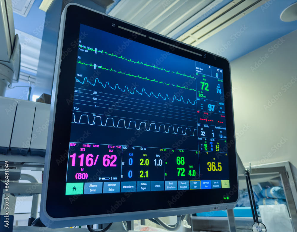 Foto de hospital monitor displaying vital signs heart rate, blood