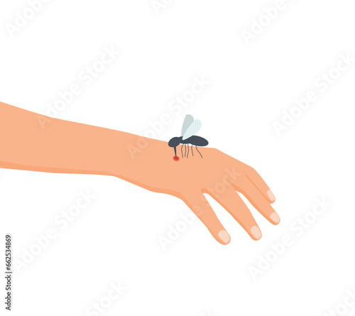 Mosquito bites human hand with swollen bump