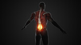 Fibromyalgia or medical conditions of back pain