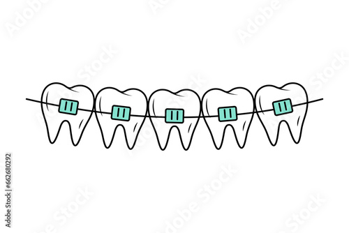 Teeth with braces in doodle style. Corrective Orthodontics. Dental care. Linear vector illustration.