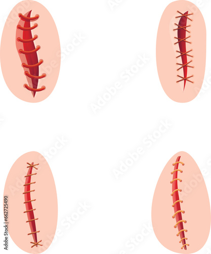 Surgical suture icons set cartoon vector. Various type of operating suture. Surgery, healthcare concept