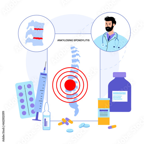 Ankylosing spondylitis disease