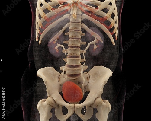 CT scan of Kidney and Urinary bladder system: KUB 3D rendering image  showing both kidney Urinary and  bladder after injection contrast media agent.