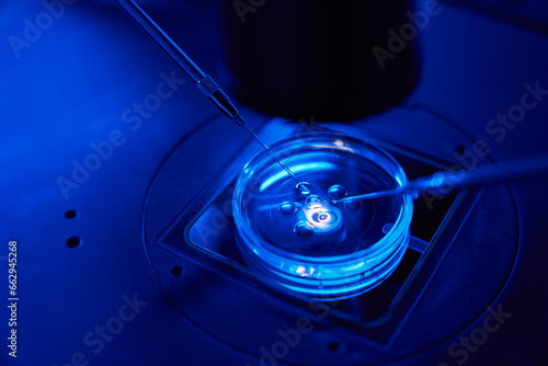 Bilde på lerret Closeup of intracytoplasmic sperm injection being performed in Petri dish