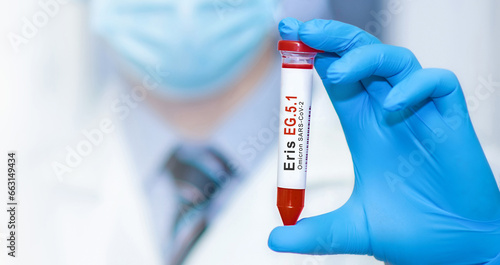 Doctor holding a test blood sample tube for the detection of the new Omicron variant Eris EG.5.1 on the background of medical test tubes.