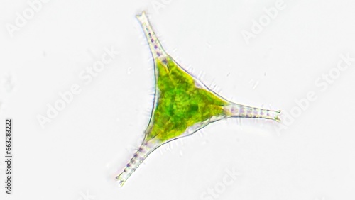 Obraz na plátně Freshwater microalgae, Staurastrum sp