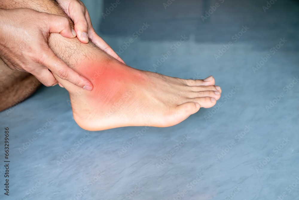Man's hand is holding his ankle due to pain, ankle inflammation, sprained ankle, abnormal gait
