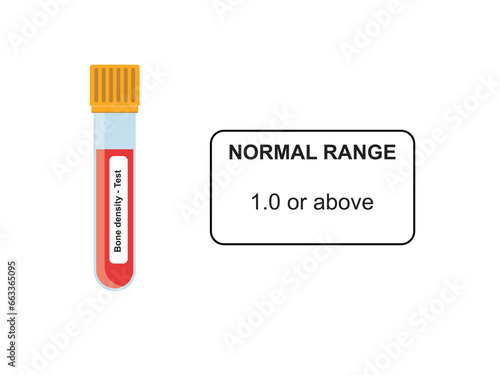Bone density Blood Test Concept Design. Vector Illustration.