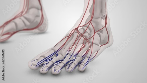 Diabetic blood vessel damage in the feet