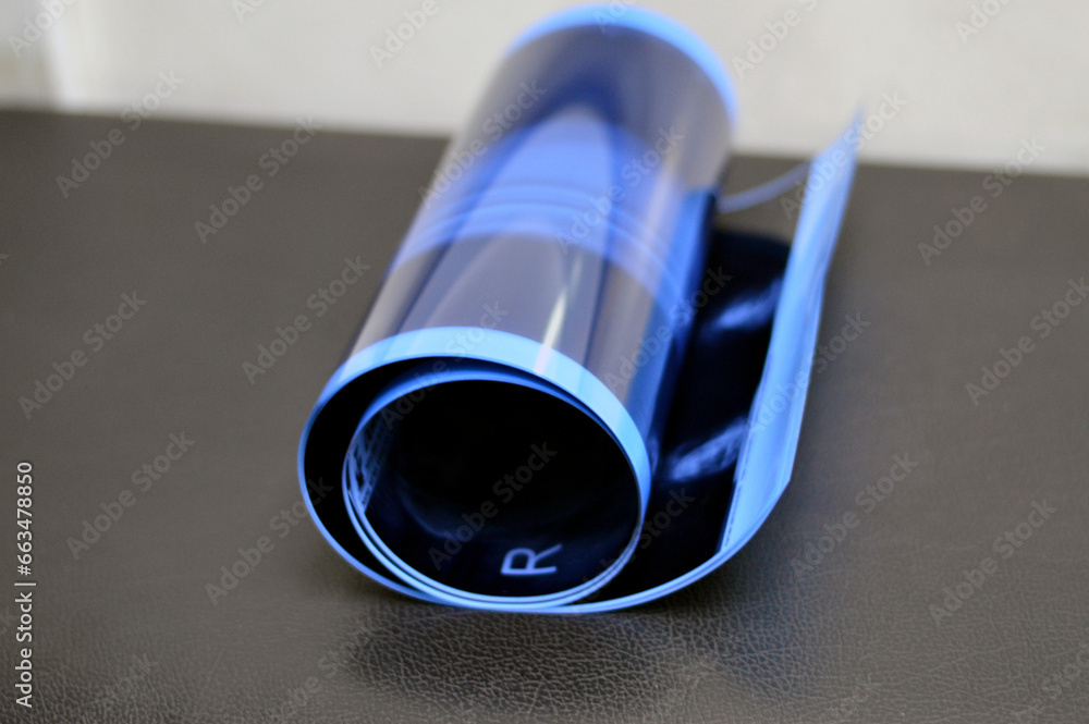 Plain X Ray Rolls Of A Medical Case Before Total Knee Replacement Plain x ray rolls of a medical case before total knee replacement