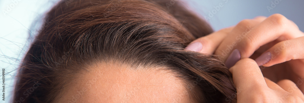 Fototapeta premium woman with hair problem