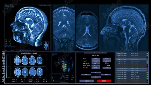 MRI brain scanning animation. Neurology data, vital signs on display Future technology. HUD, interface. 