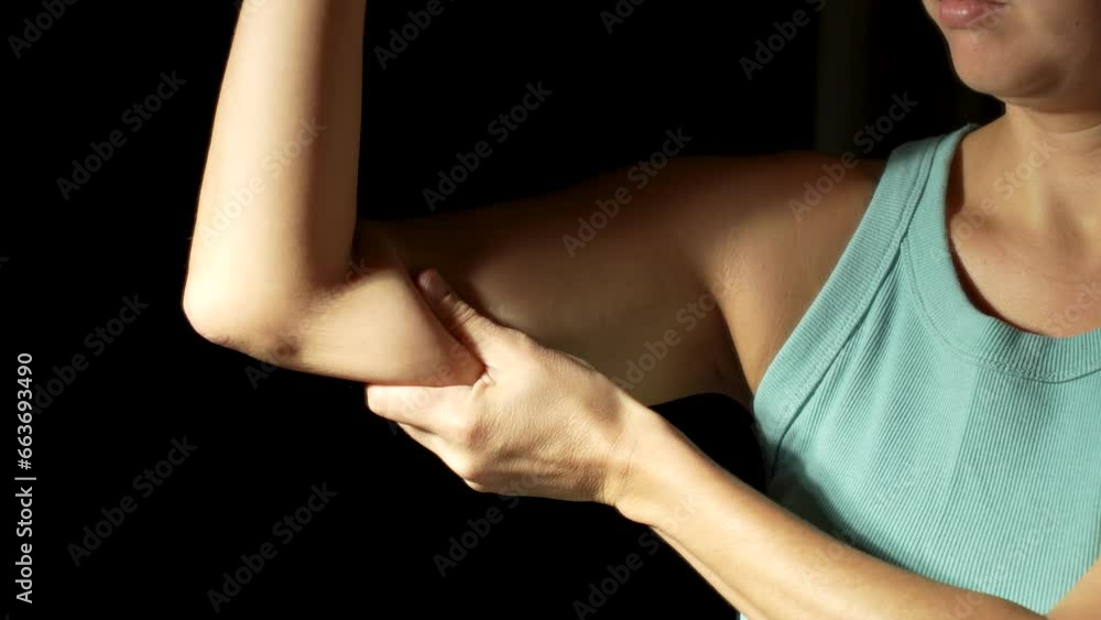 Young woman with cellulite arms, close-up Young woman with cellulite arms, close-up