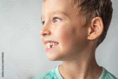 The child shows baby teeth. Pediatric dentistry and periodontology  bite correction. Health and dental care  caries treatment  baby teeth