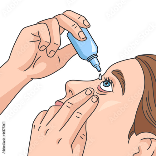 Woman putting drops in her eye diagram schematic vector illustration. Medical science educational illustration