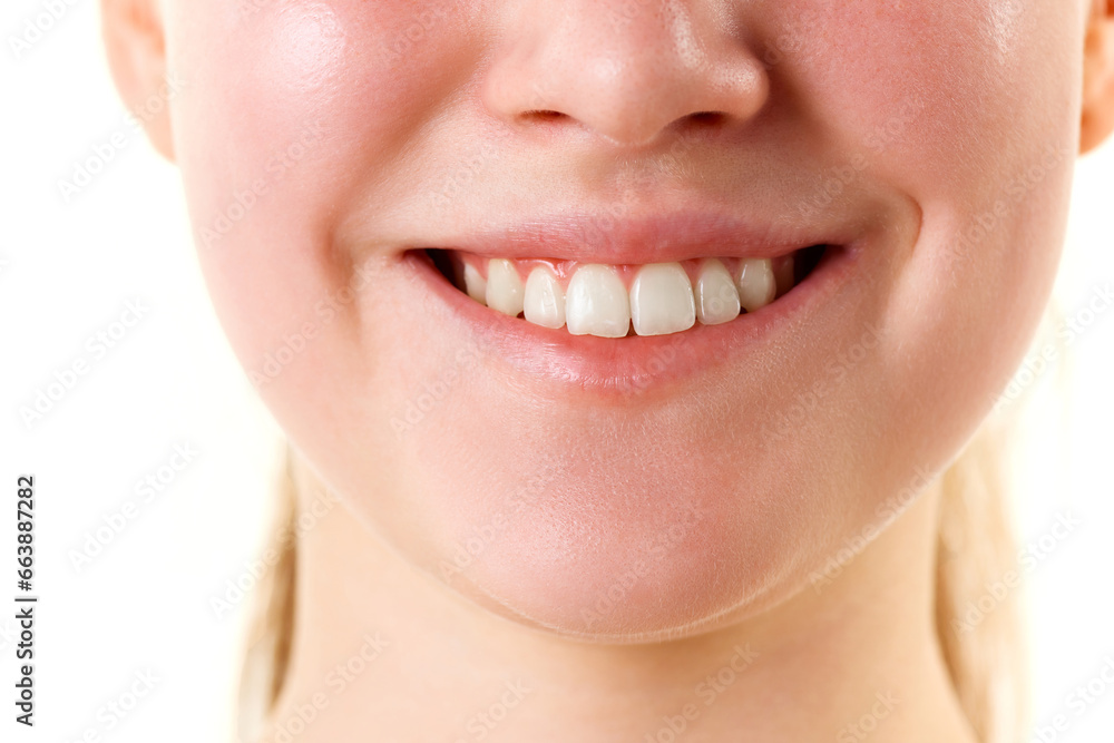 Obraz premium Cropped photo of young smiling with teeth female face, lips without lipstick. Natural gloss of lips and woman's skin. Increase in lips, cosmetology.